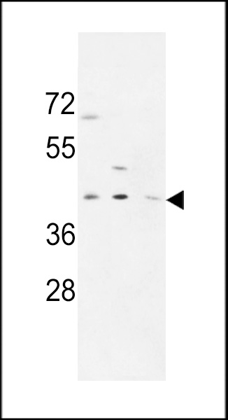 WB - PR38A Antibody  (C-term) AP9930b